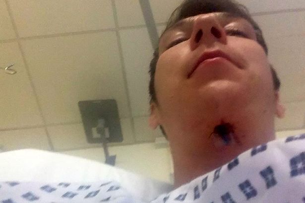 PAY-Jakes-surgery-scars