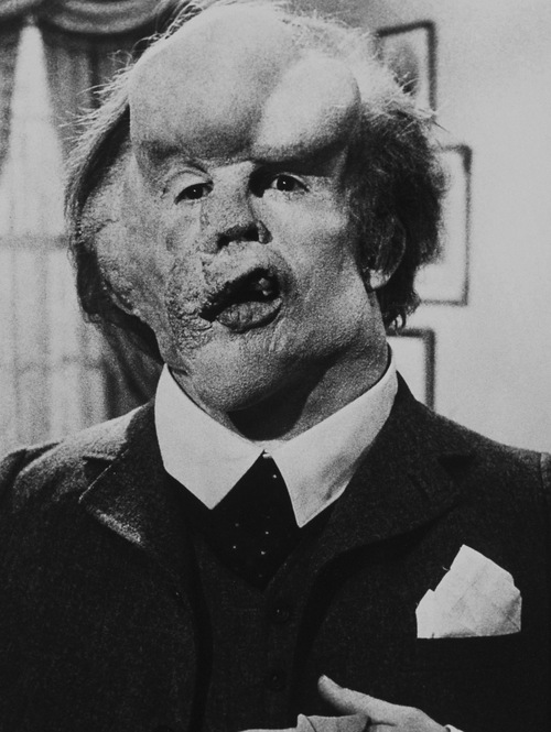 600full-the-elephant-man-screenshot